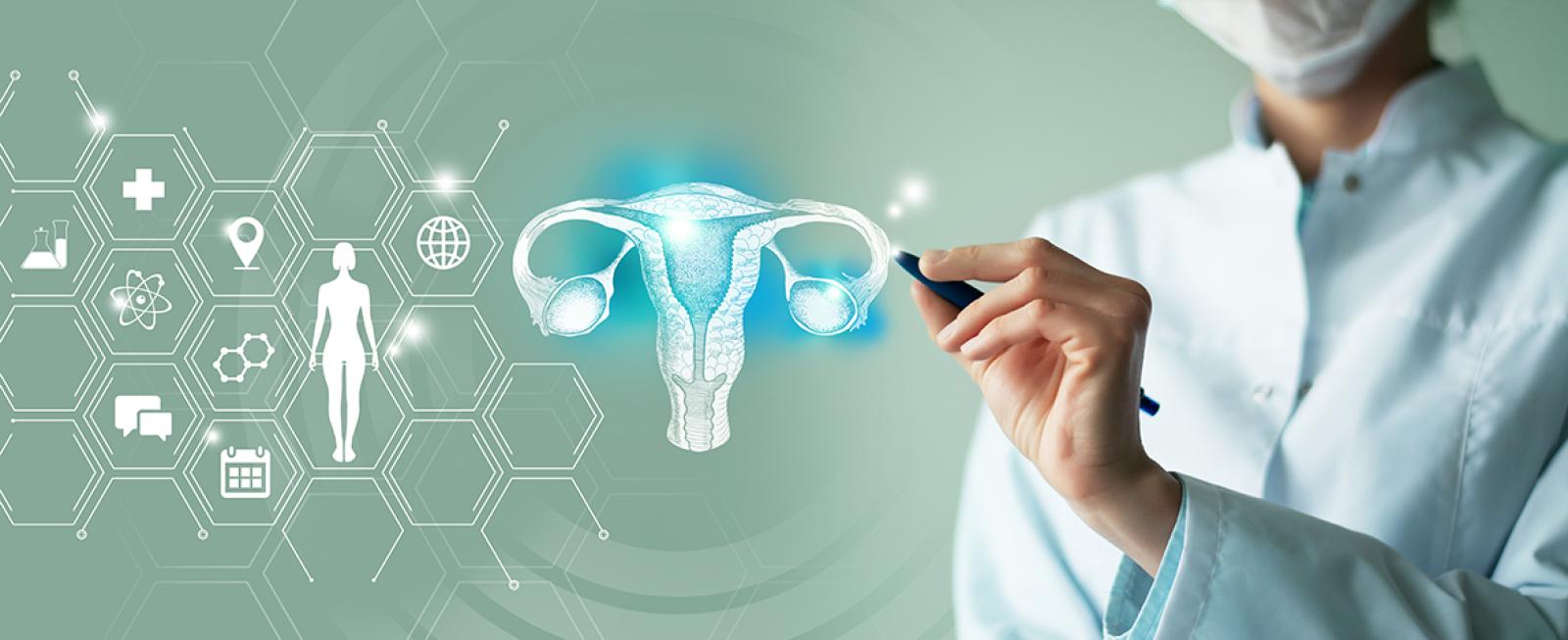 Polycystic ovary syndrome (PCOS)