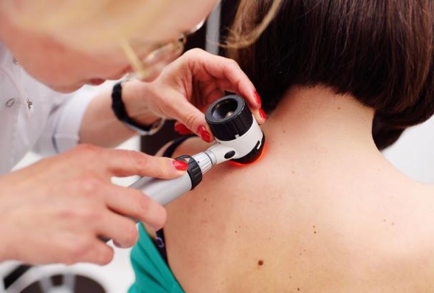 Skin Check,  Do I need one?